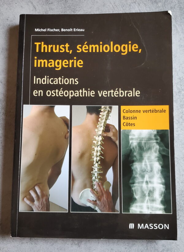 Thrust, sémiologie, imagerie Indications en ostéopathie vertébrale